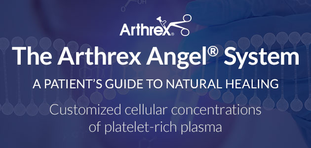 The Arthrex Angel® System
