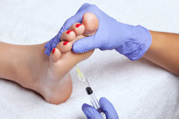 prp injections